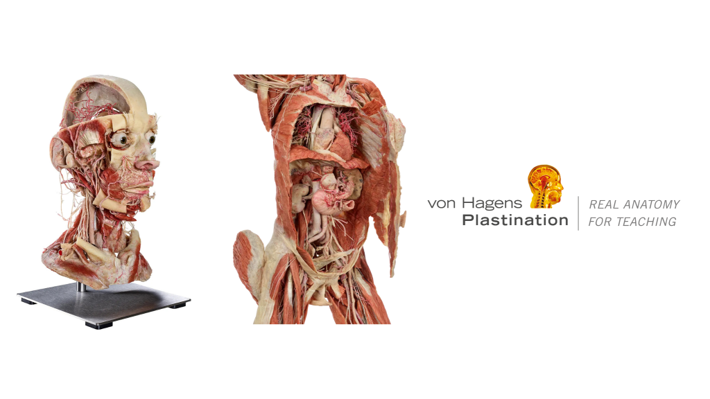 Plastinasi Von Hagens